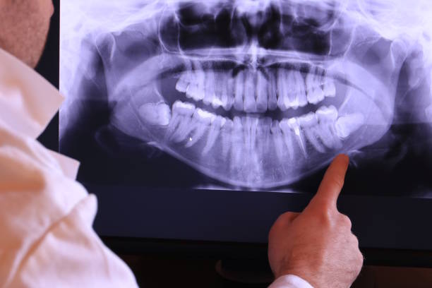 Best Mobile Emergency Dentist in Jurupa Valley, CA